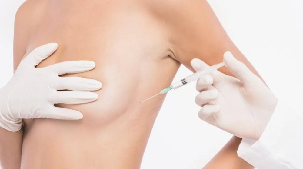 自體脂肪隆乳費用多少？3種適合族群公開，效果與價格一次看懂
