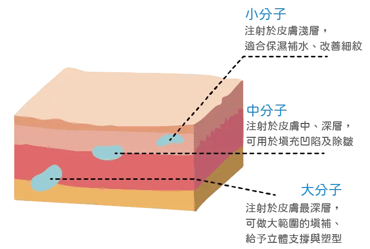In addition, hyaluronic acid is also classified by large and small molecules, each with different effects and suitable areas! Specifically, you can think of large molecules as firmer and more elastic hyaluronic acid, whereas small molecules are softer and smoother hyaluronic acid.