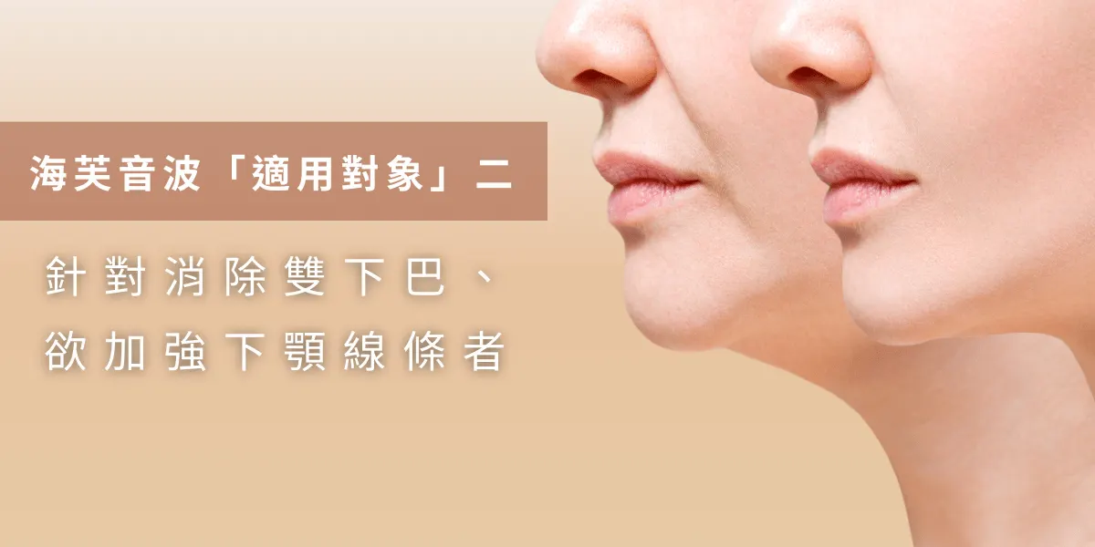 Who Ultraformer is for #2: people who want to eliminate a double chin and define the jawline