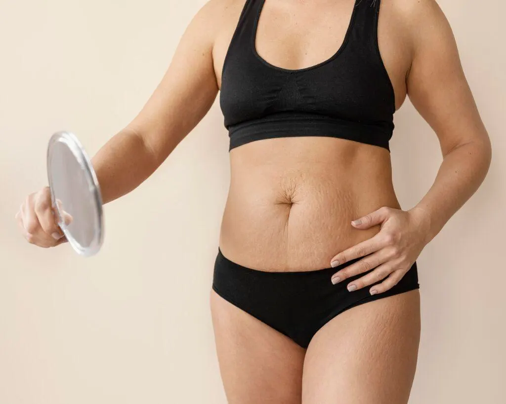 Cellulite on Your Body? 3 Aesthetic Treatments to Smooth It Out