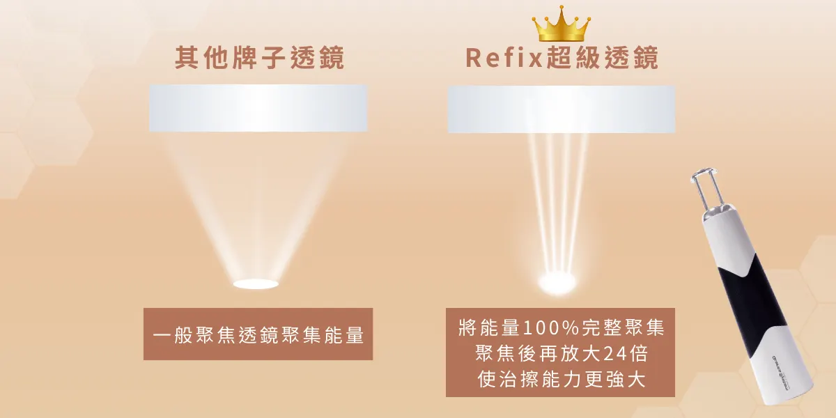 24倍的聚焦能量在皮下形成光學空泡效應和光震效應，促使膠原母細胞大量活化，進而修復受損的皮膚，並促使新生膠原及彈性蛋白，從而達到緊縮毛孔和預防粉刺再生的效果。

探索皮秒雷射乃來自義大利頂尖雷射製造商Quanta 系統的最新技術。

作為全球雷射領域的先驅，Quanta 系統致力於外科雷射手術領域十餘年，深耕技術研發，並取得眾多國際認證，包括ISO13485、CE、FDA和MDD certificate等，經過長時間的實踐驗證，被眾多醫學機構及專業醫生視為最值得信賴的合作夥伴之一。