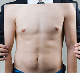 你其實有男性女乳症!怎麼判斷?改善方式全公開