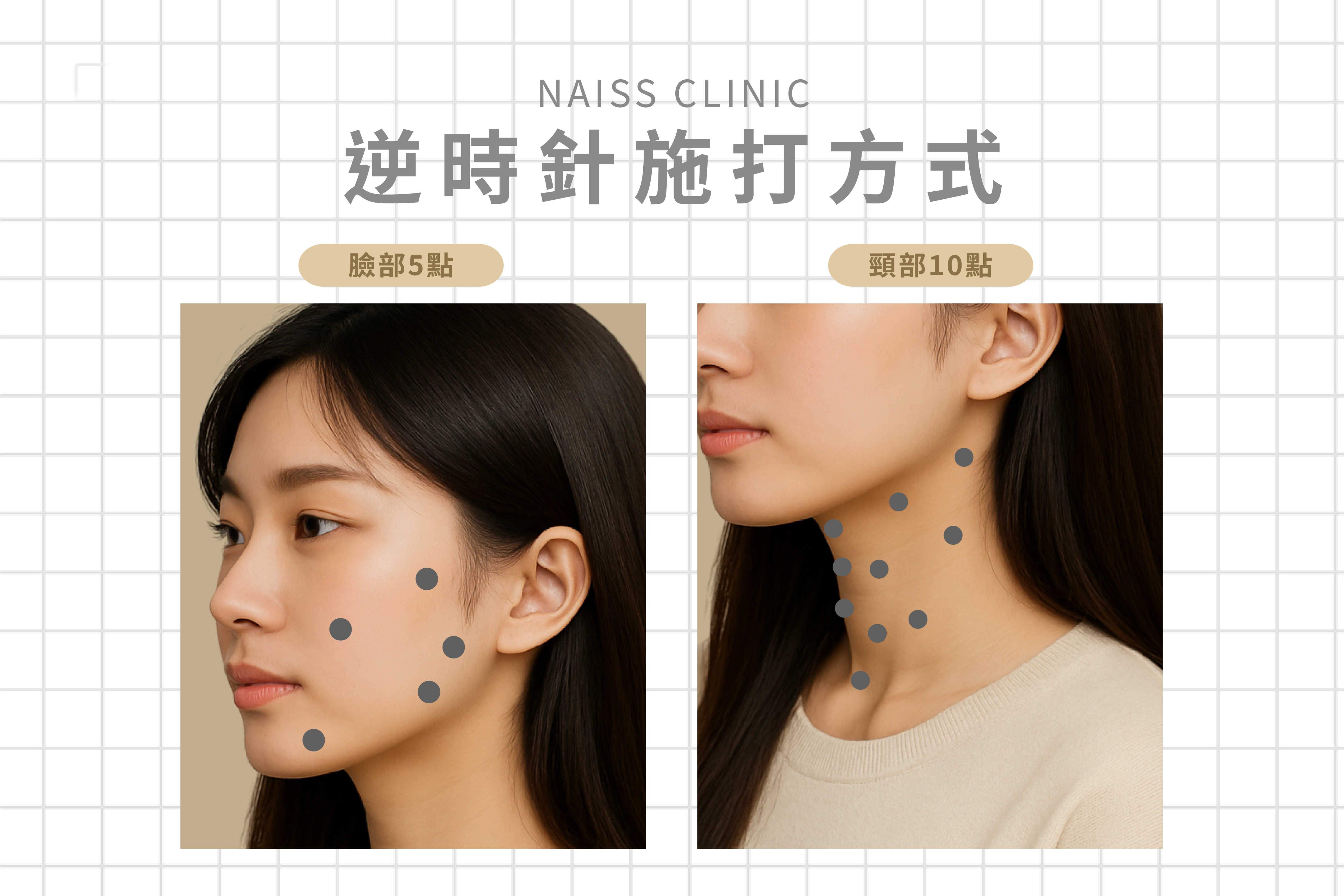 逆時針Profhilo要怎麼打？只要打5個點？