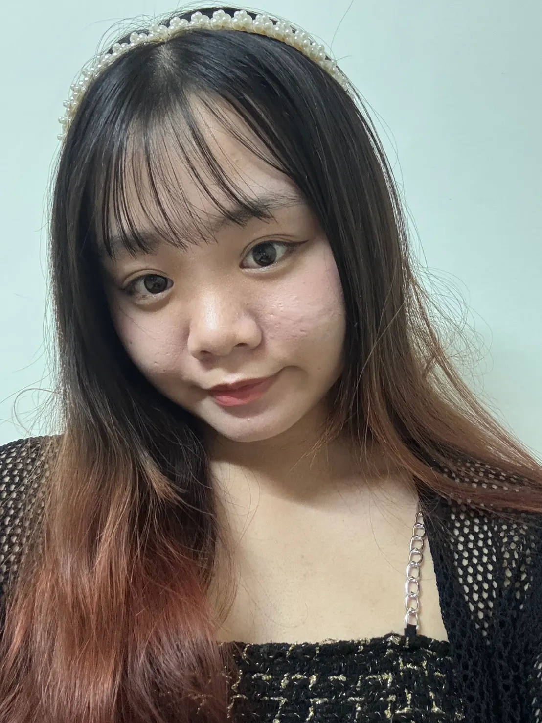 妞妞戴珍珠髮箍的近期生活照，經 PLT 生長因子療程後自在面對鏡頭