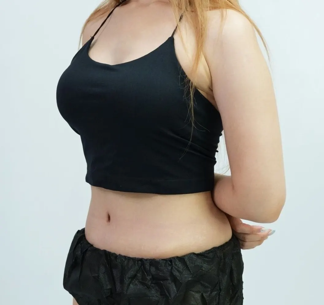 After, side view: full breasts and a flat abdomen