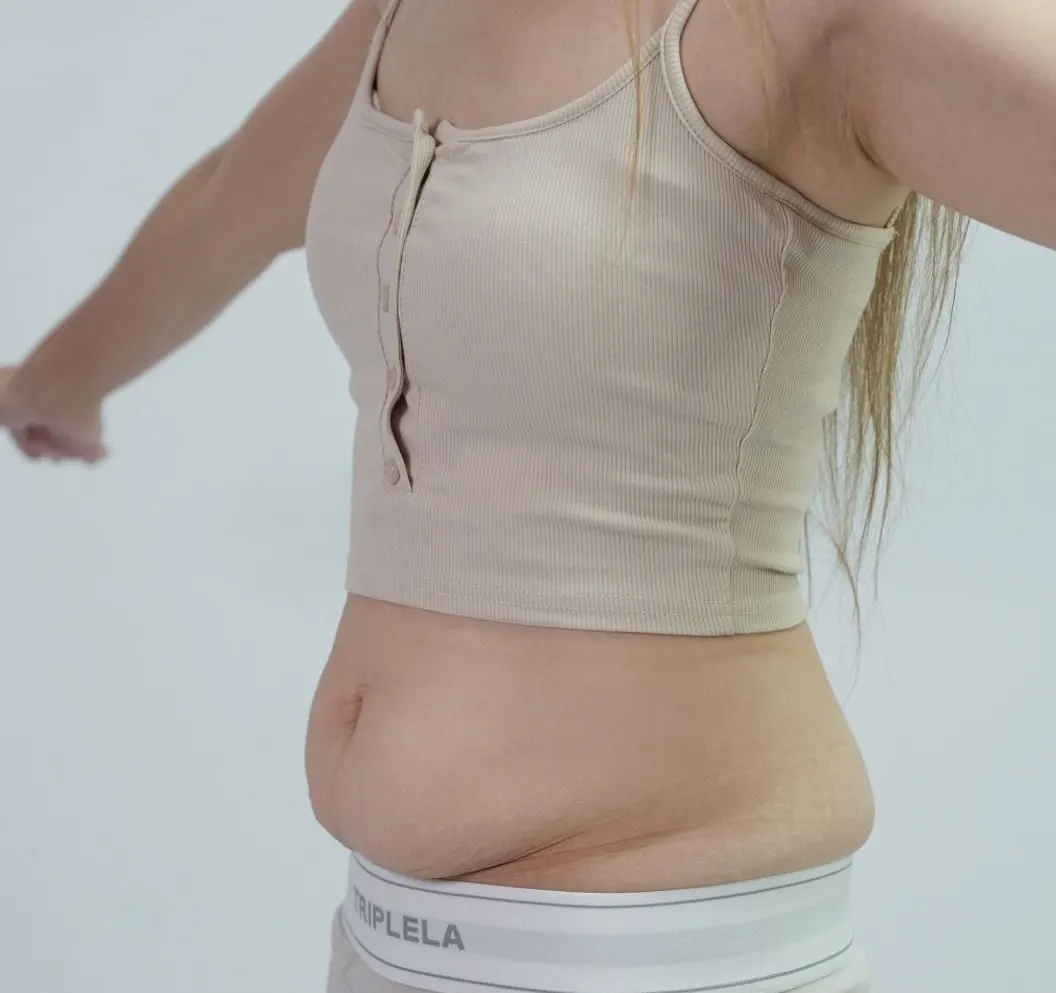 Before, side view: loose, protruding postpartum abdomen and flat breasts