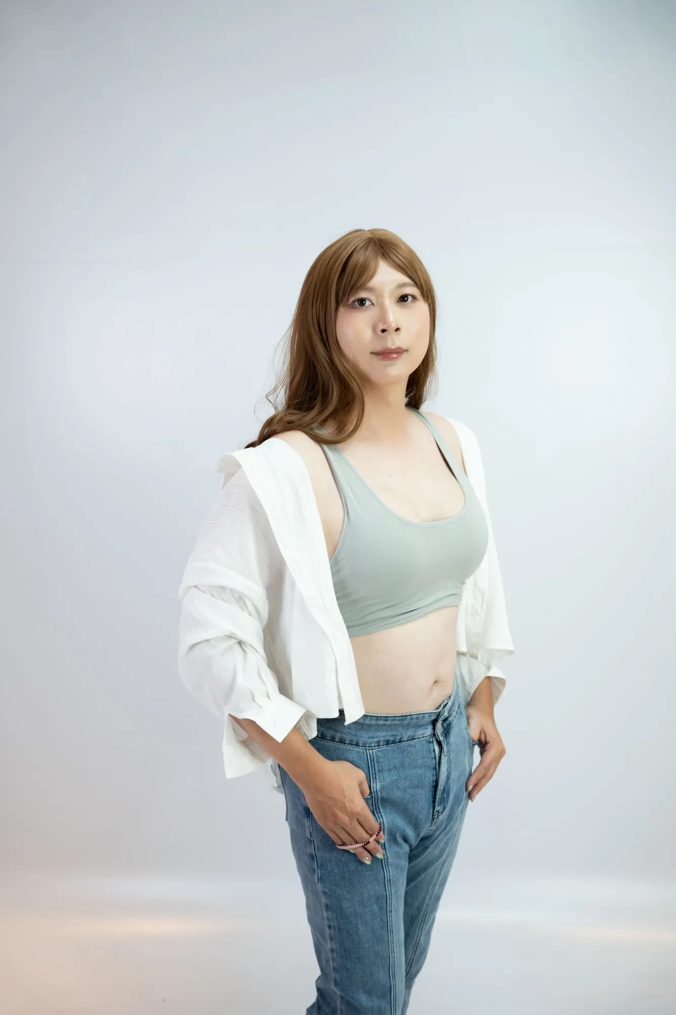 Athena 珍珠波隆乳術後，胸型與身材比例協調