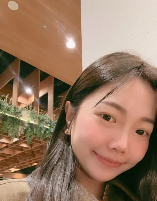 雙下巴抽脂案例：Winny 雙下巴抽脂後，下顎線清晰可見