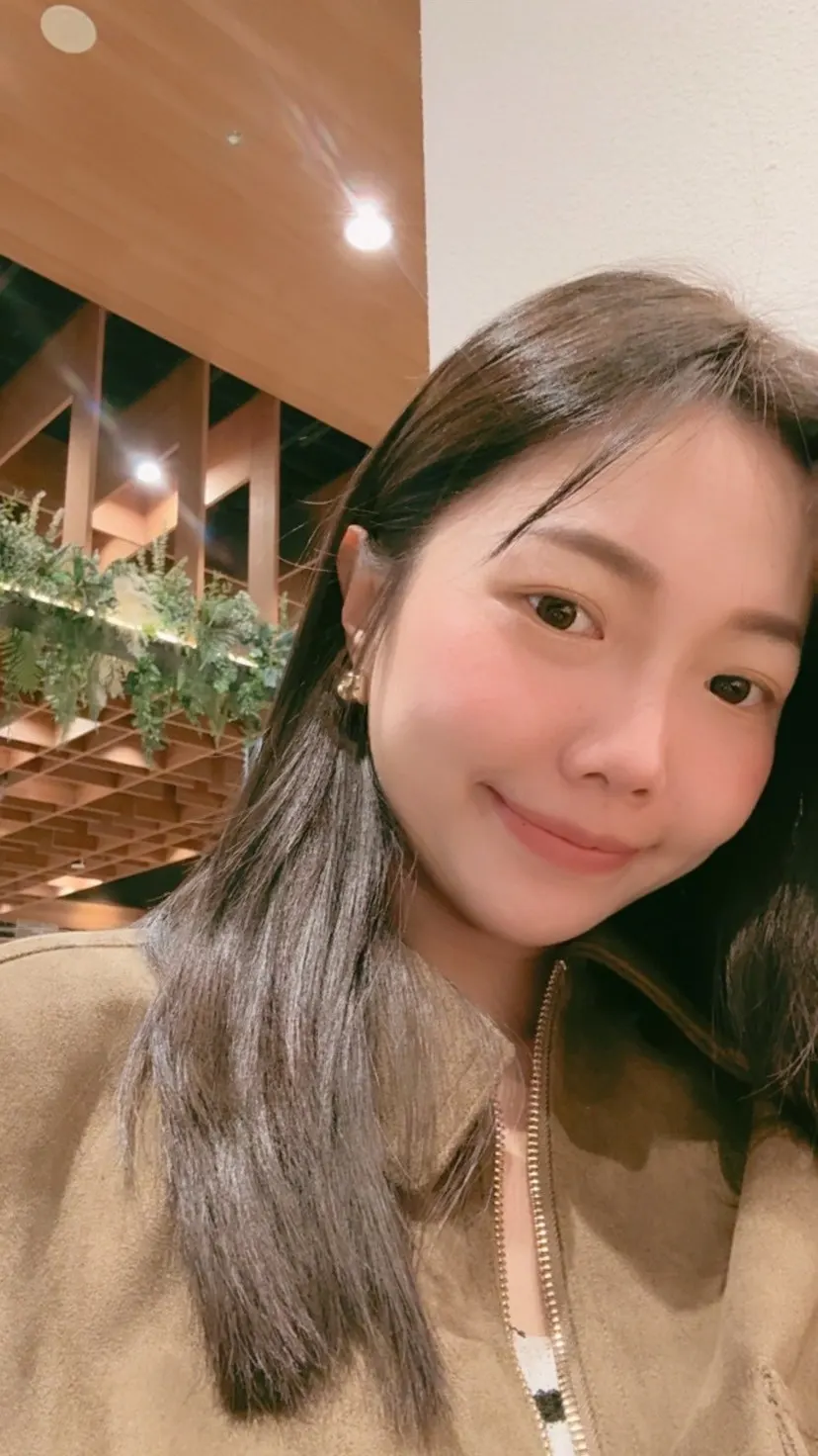 雙下巴抽脂案例：Winny 雙下巴抽脂後，下顎線清晰可見