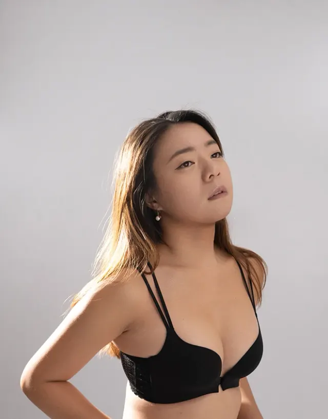自體脂肪隆乳心得分享-抽脂補胸效果佳，二度提升飽滿胸型