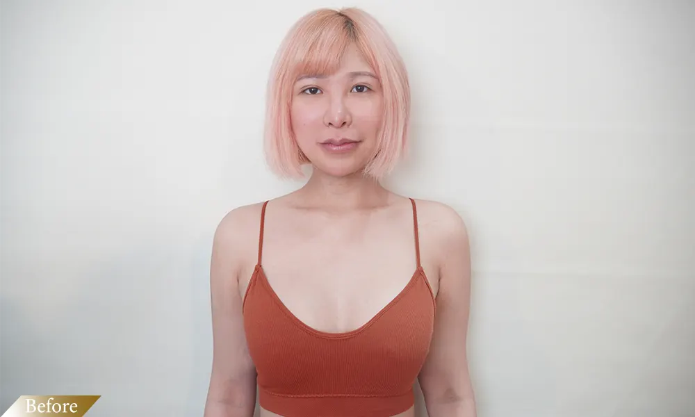 療程前
