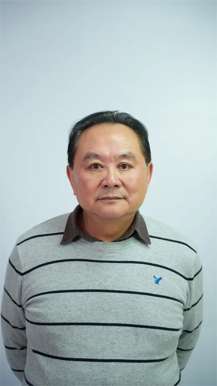 眼袋手術案例分享｜拿掉疲憊感，找回年輕自信
