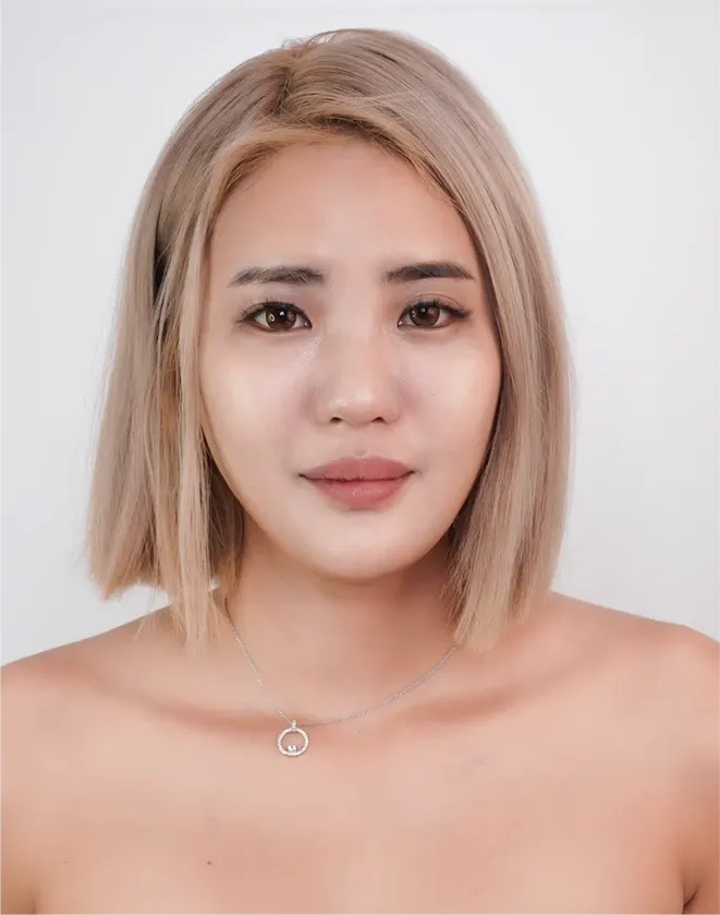 療程前