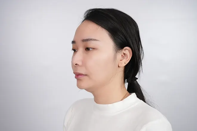 療程前